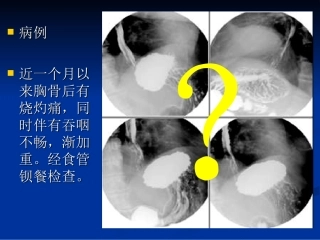 食管的正常X线表现