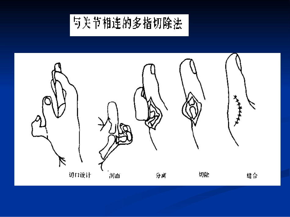 四肢整形美容手术_第3页