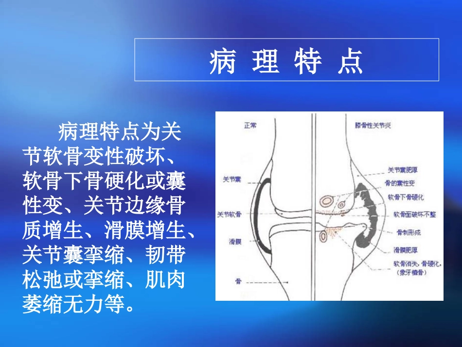 全膝关节置换术_第3页