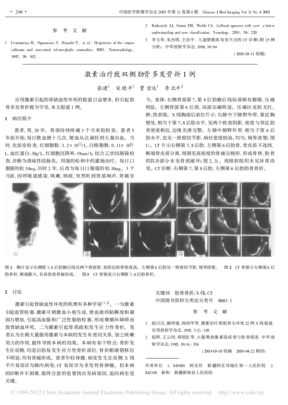 胼胝体发育不全的MRI诊断_第3页