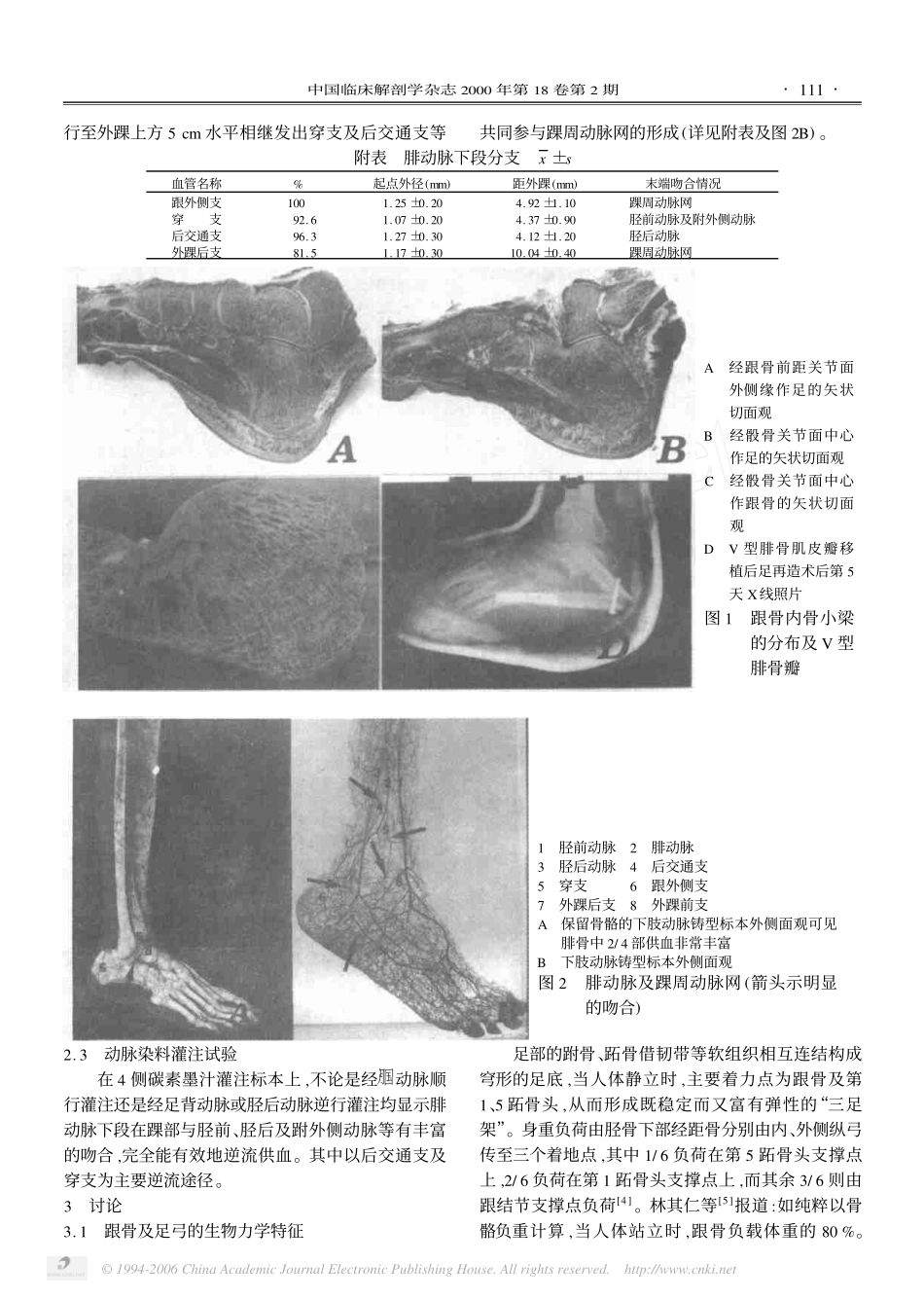 逆行岛状V 型腓骨肌皮瓣修复后足缺损的应用解剖_第2页
