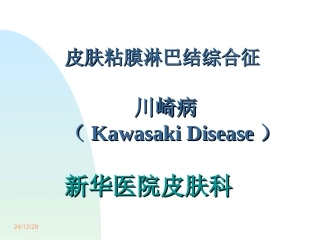 皮肤粘膜淋巴结综合征川崎病