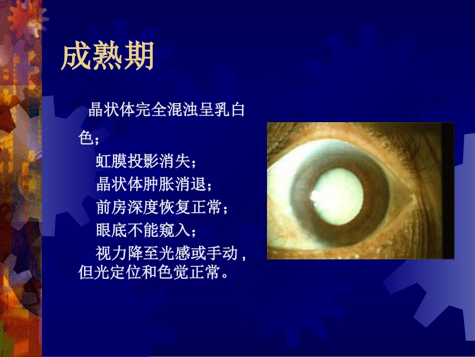 皮质性白内障的分期(四期)_第3页
