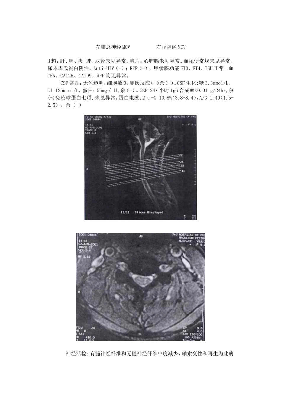 双下肢疼痛 3月_第2页