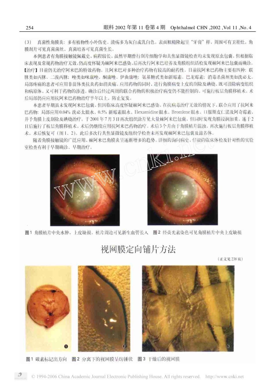 视网膜定向铺片方法_第3页