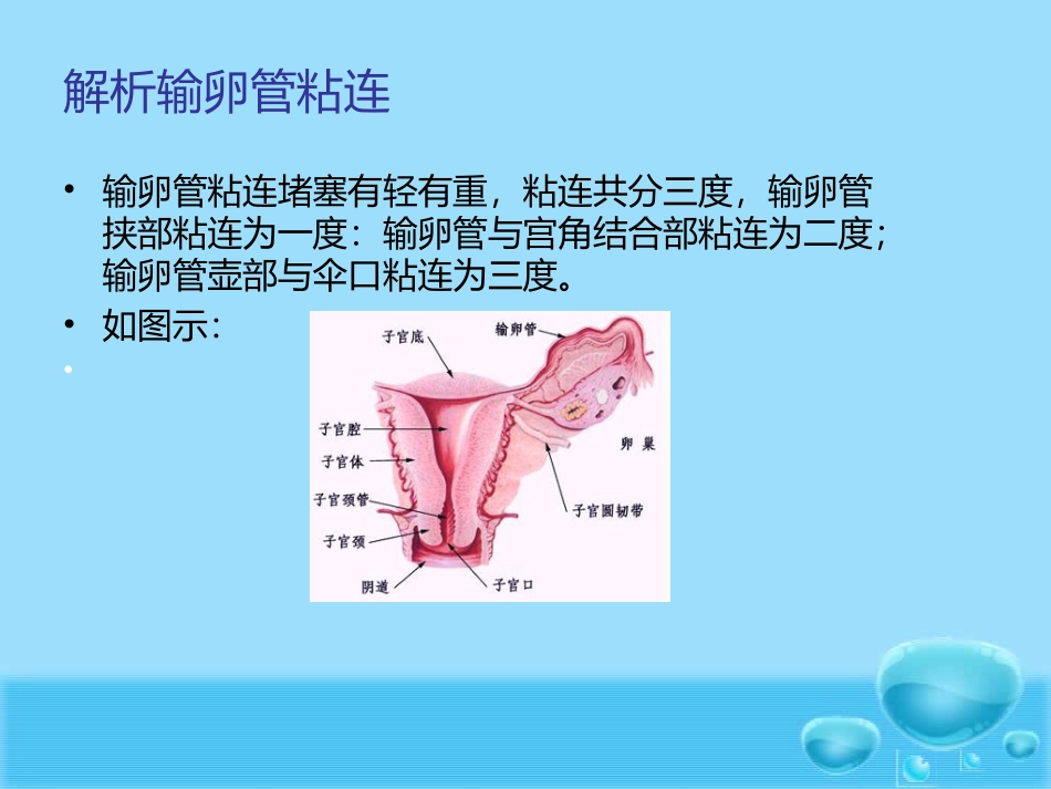 输卵管粘连手术_第2页