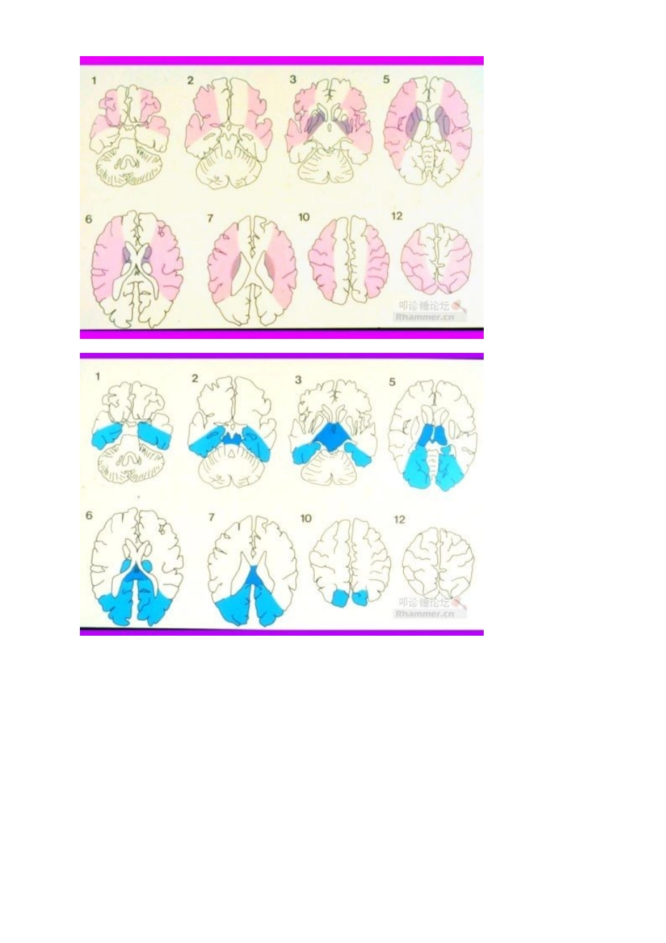 脑动脉供血区域图_第3页