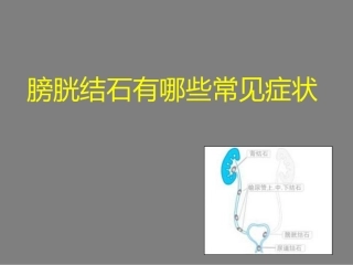 膀胱结石有哪些常见症状