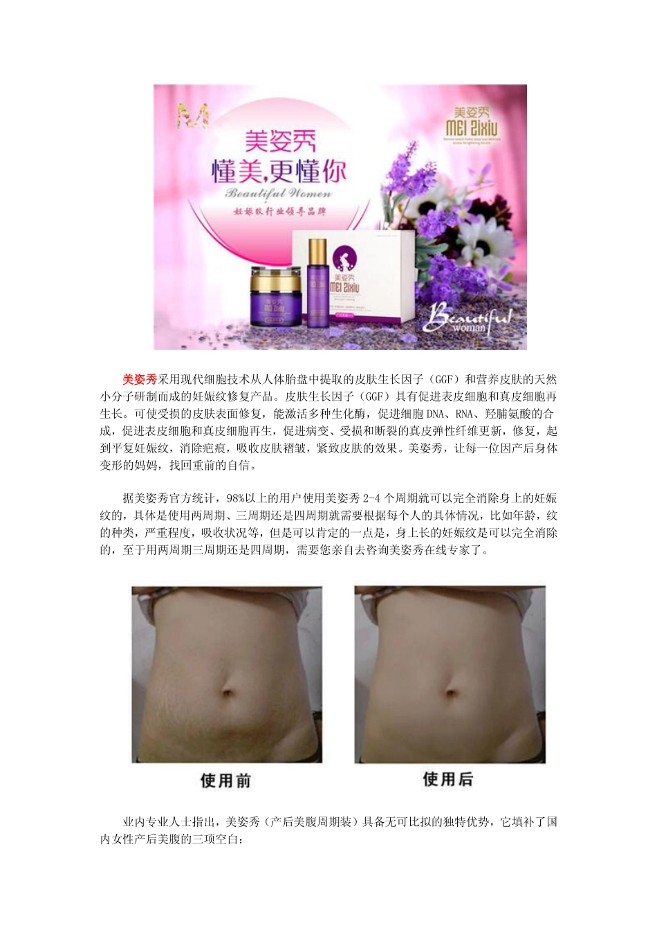 妊娠纹和刨腹产疤如何解决 妊娠纹特别严重怎么办_第2页