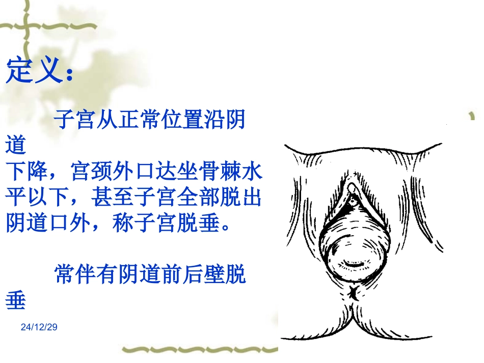 刘琳,子宫脱垂_第3页