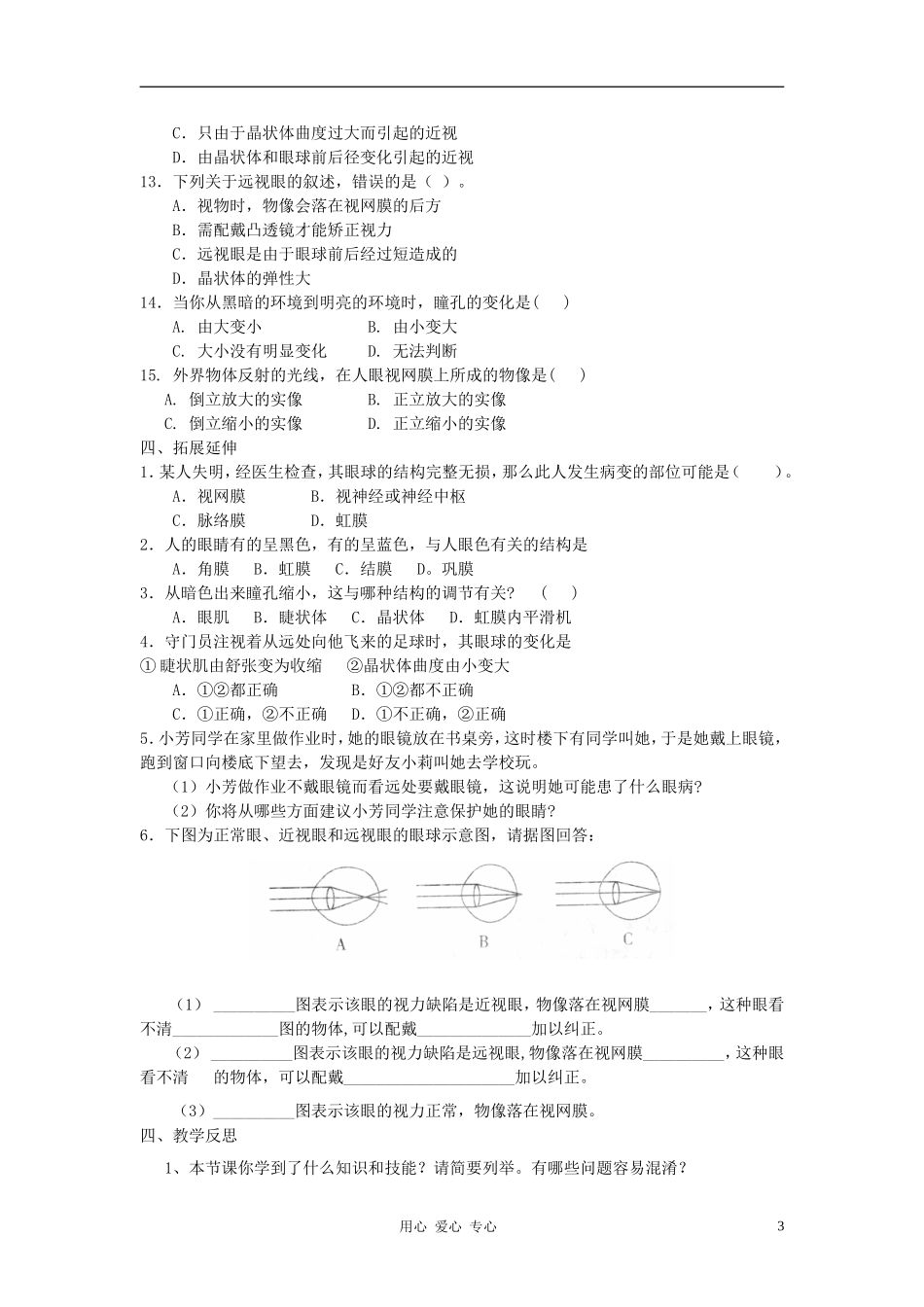 七年级生物下册《视觉的形成及近视与远视》讲学稿(无答案) 冀少版_第3页
