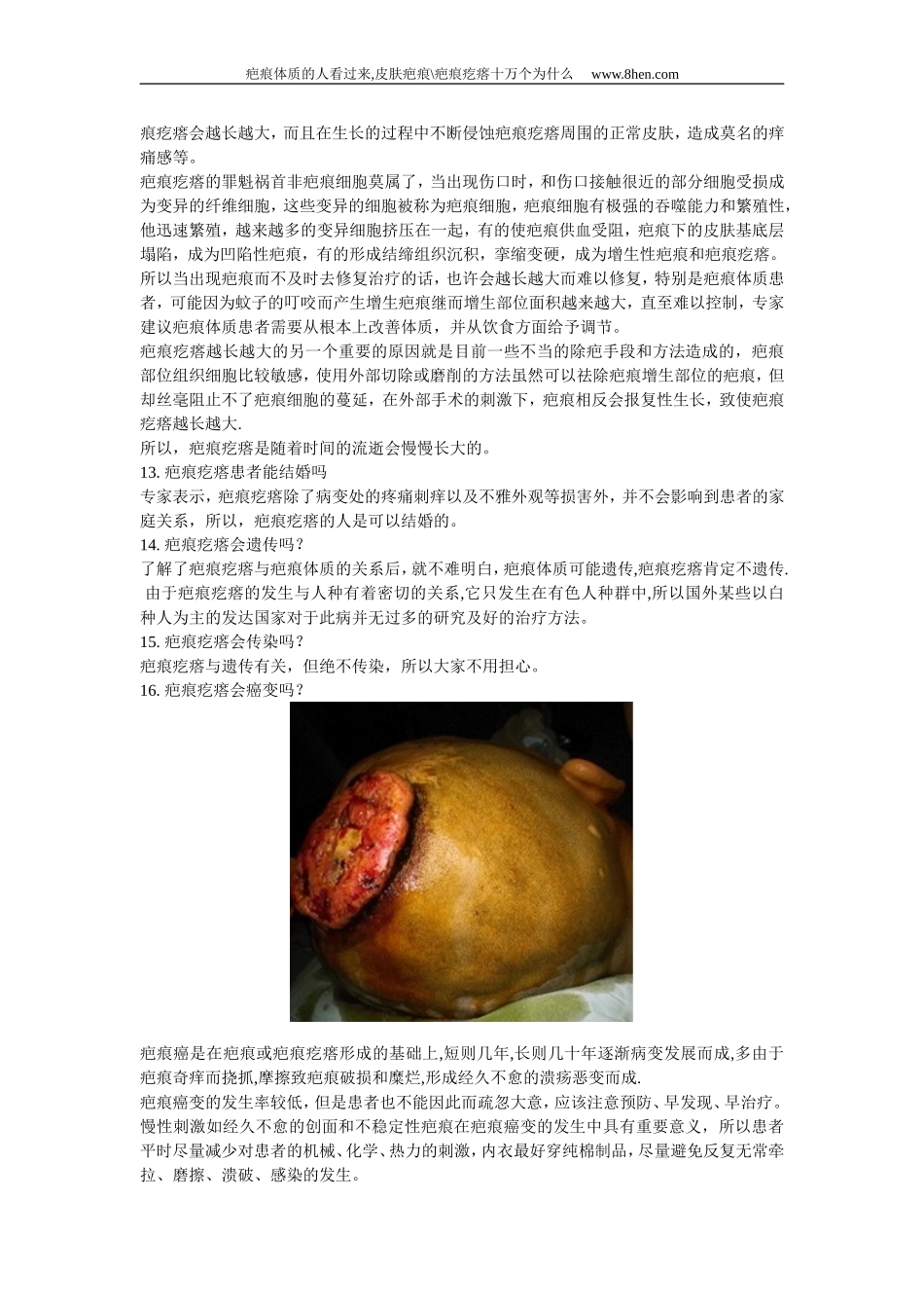 皮肤疤痕 疤痕疙瘩十万个为什么_第3页