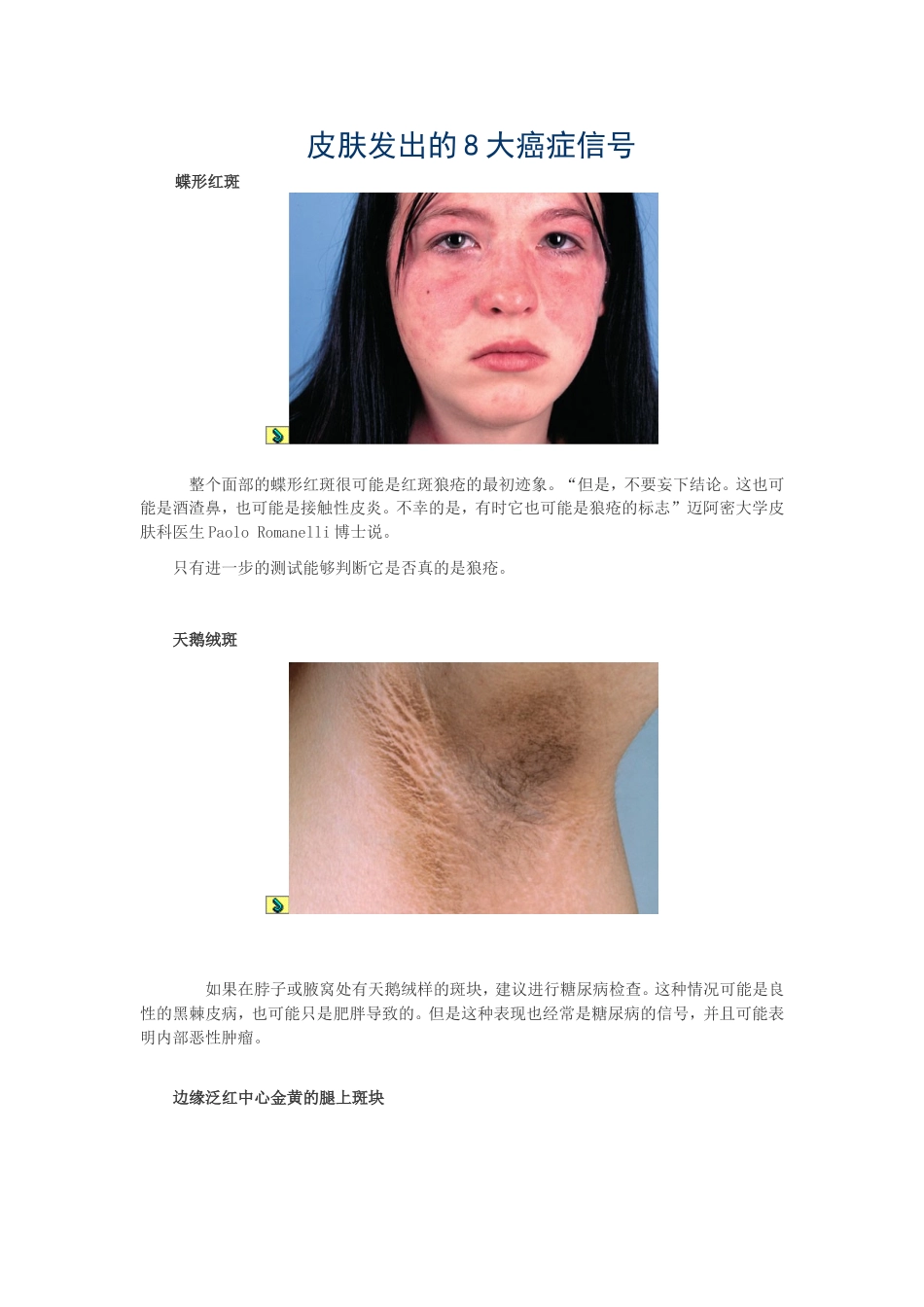 皮肤发出的8大癌症信号_第1页