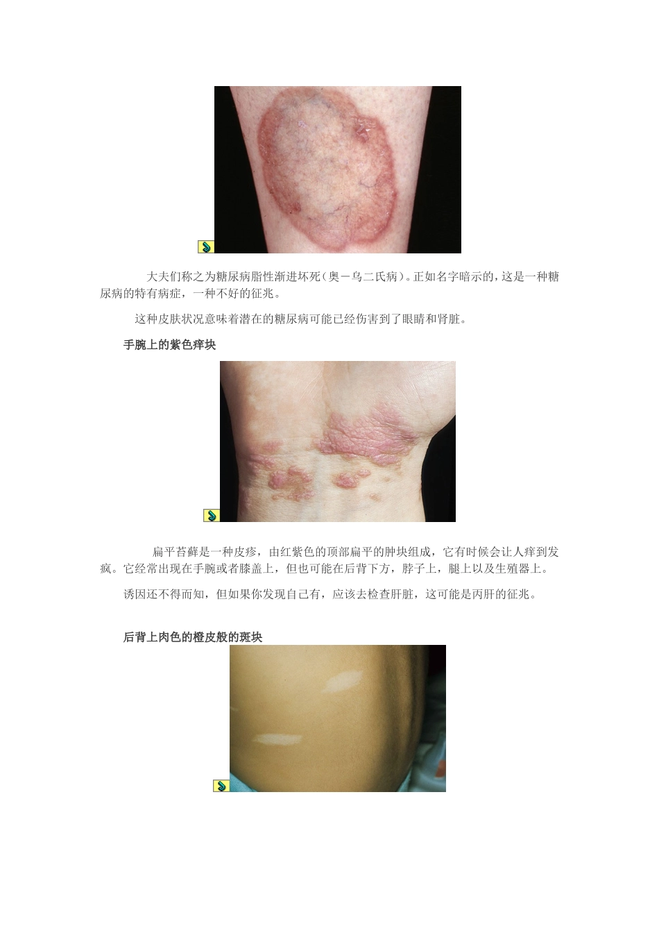 皮肤发出的8大癌症信号_第2页