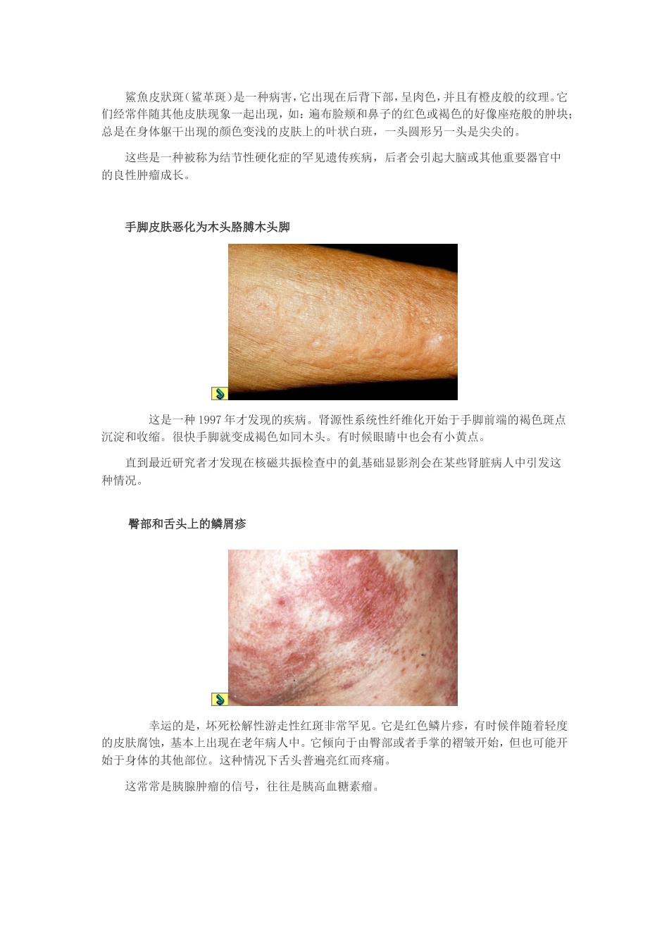 皮肤发出的8大癌症信号_第3页