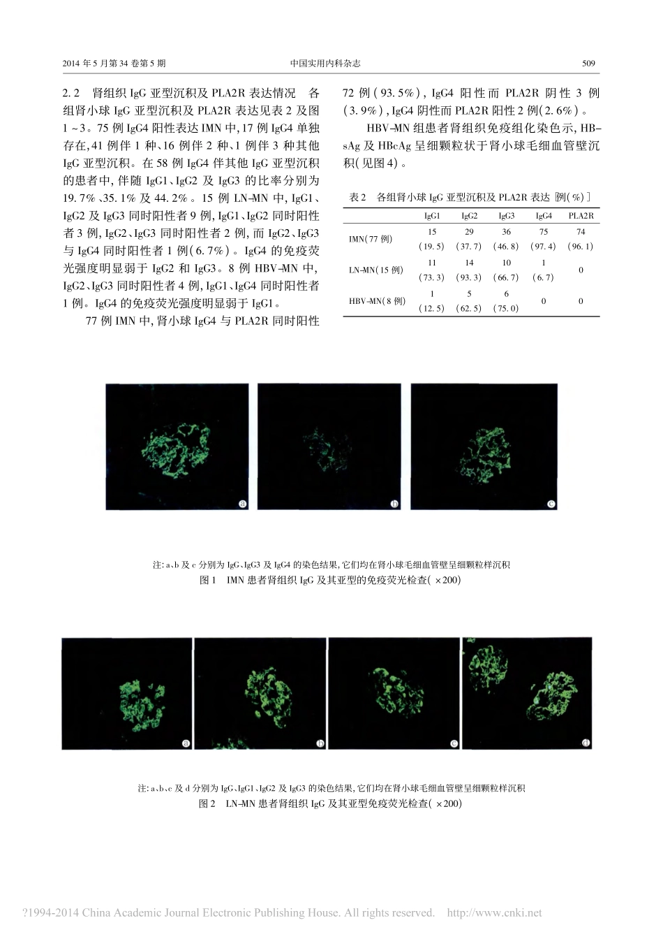 膜性肾病肾小球IgG亚型沉积及磷脂酶A2受体表达的回顾性分析_董鸿瑞_第3页