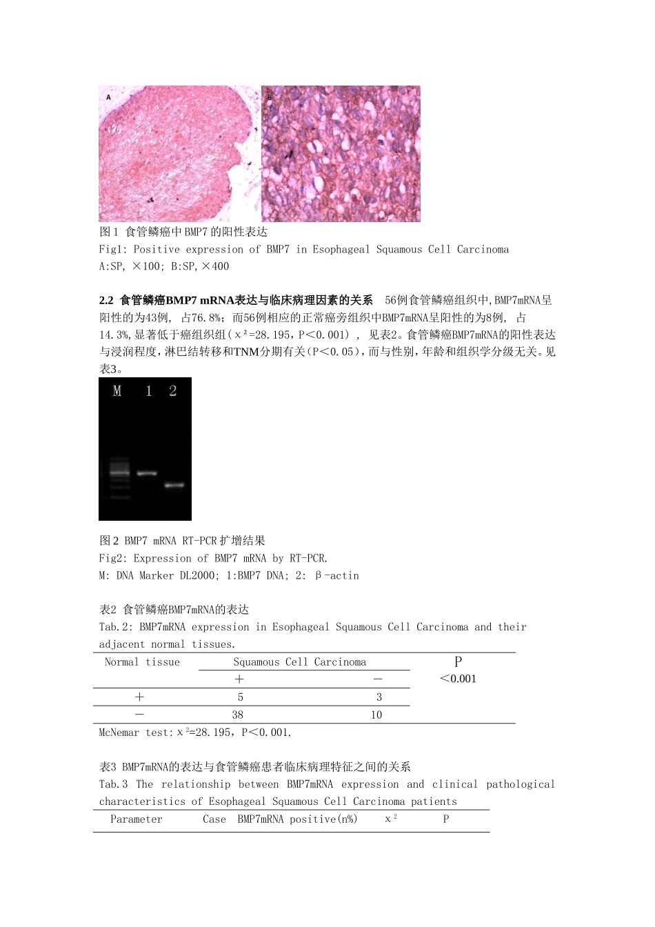 食管鳞状细胞癌组织中BMP7的表达及其临床意义_第3页