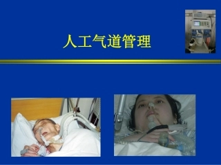 人工气道管理[35P][962KB]
