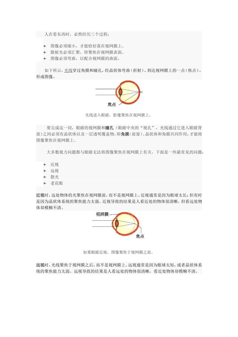 视力矫正手术工作原理_第2页