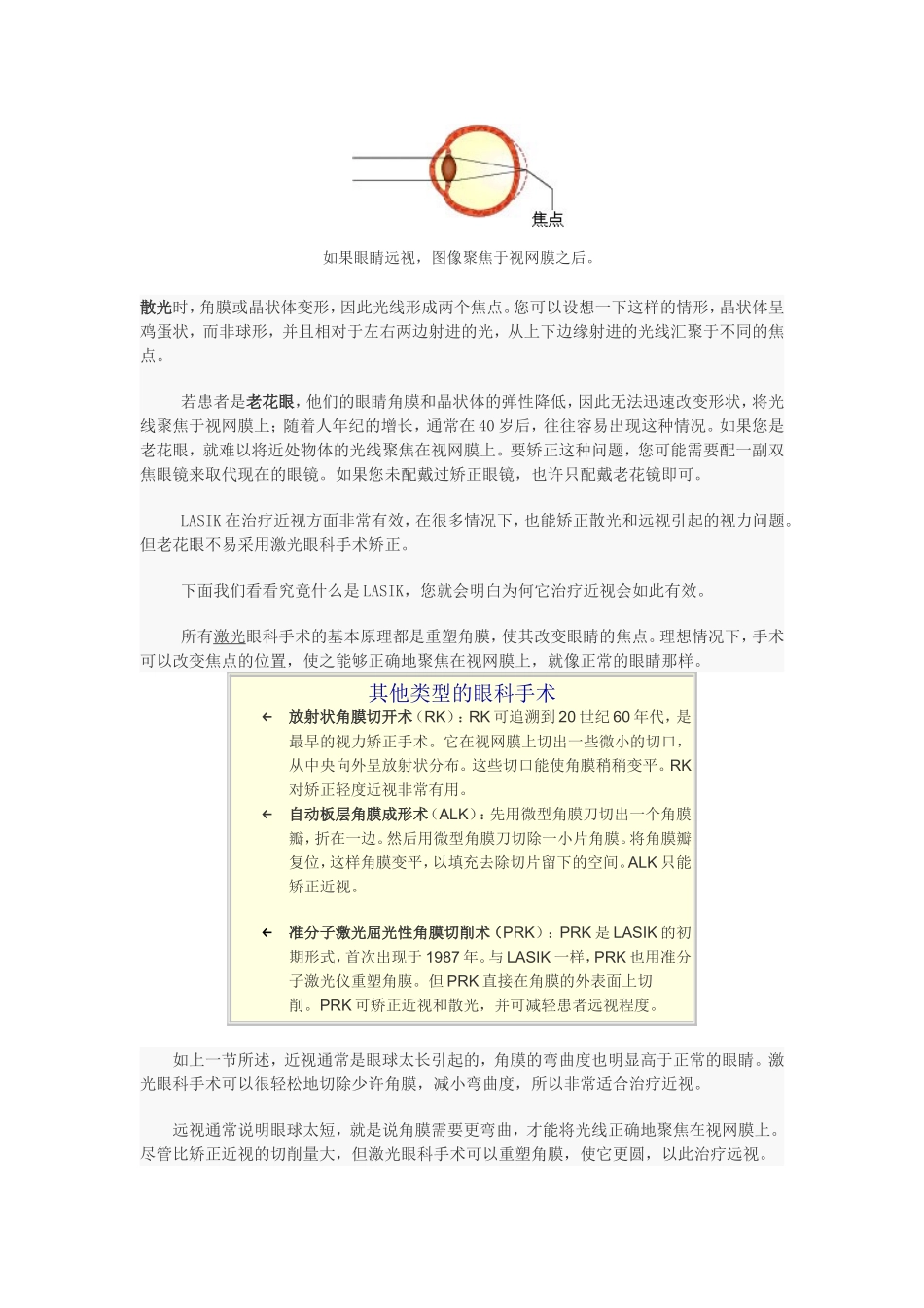 视力矫正手术工作原理_第3页