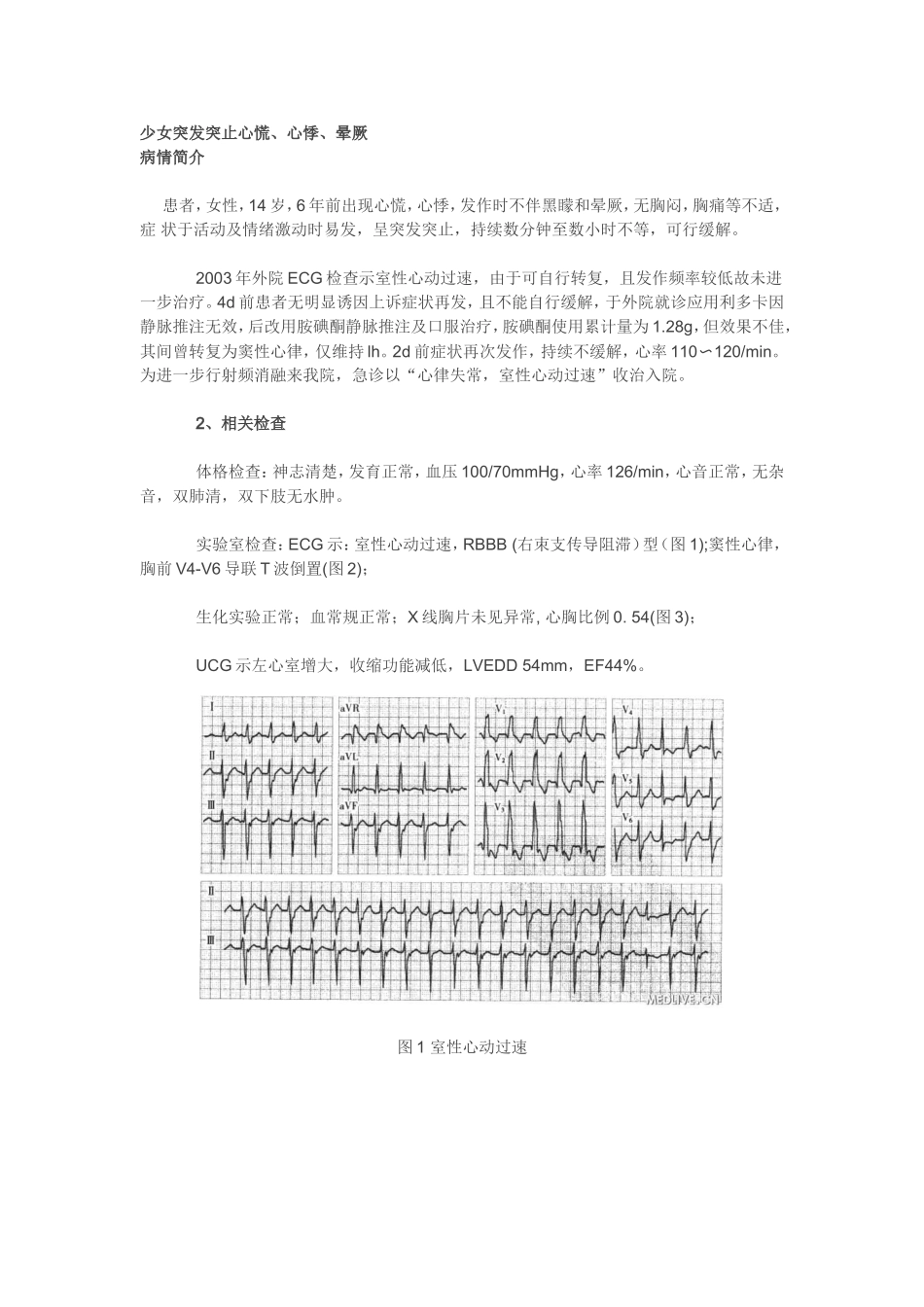 少女突发突止心慌_第1页