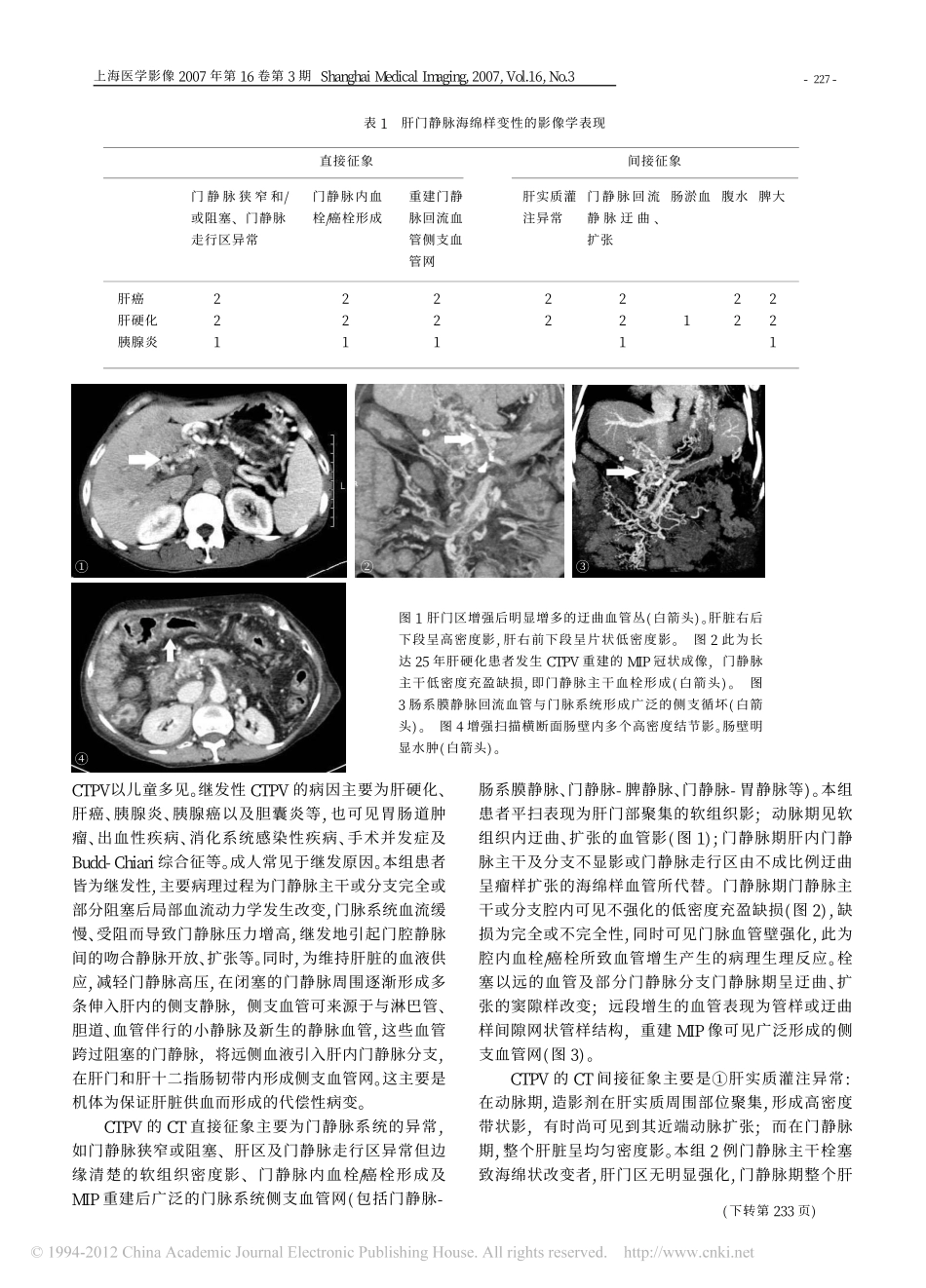 门静脉海绵样变性的MSCT表现_第2页
