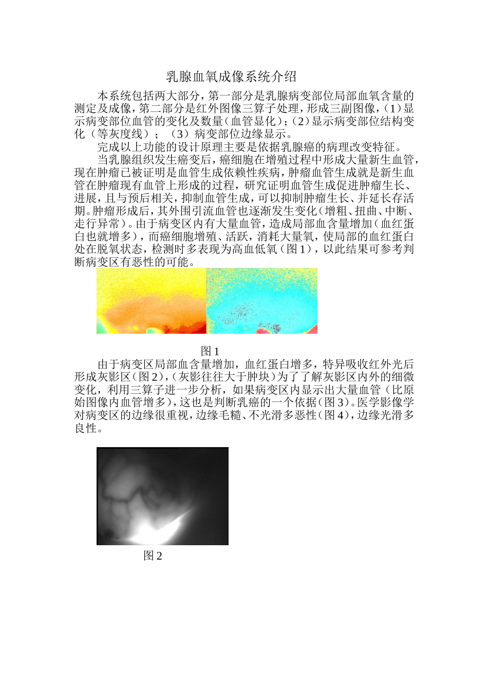 乳腺血氧成像系统介绍_第1页