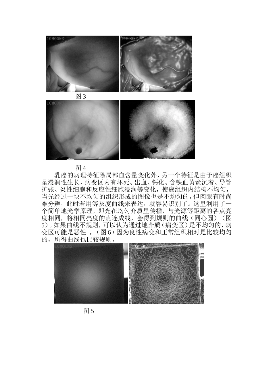 乳腺血氧成像系统介绍_第2页