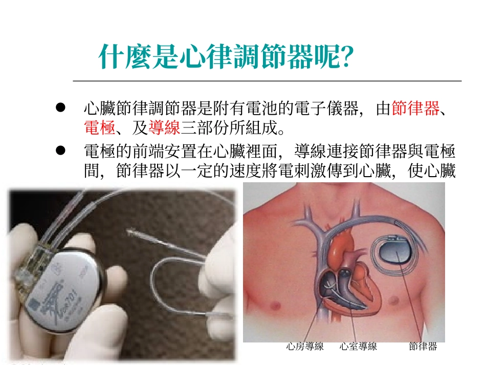 林口长庚纪念医院心脏内科心导管卫教内容_第2页