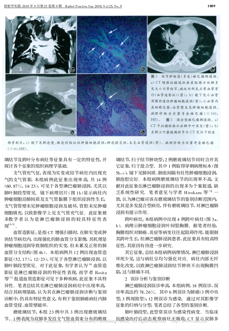 淋巴瘤肺浸润的CT表现和病理对比_曾苗雨_第3页