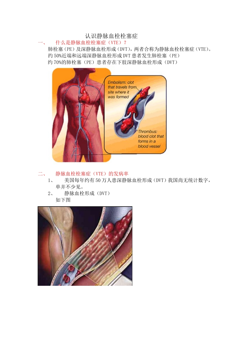 认识静脉血栓栓塞症_第1页