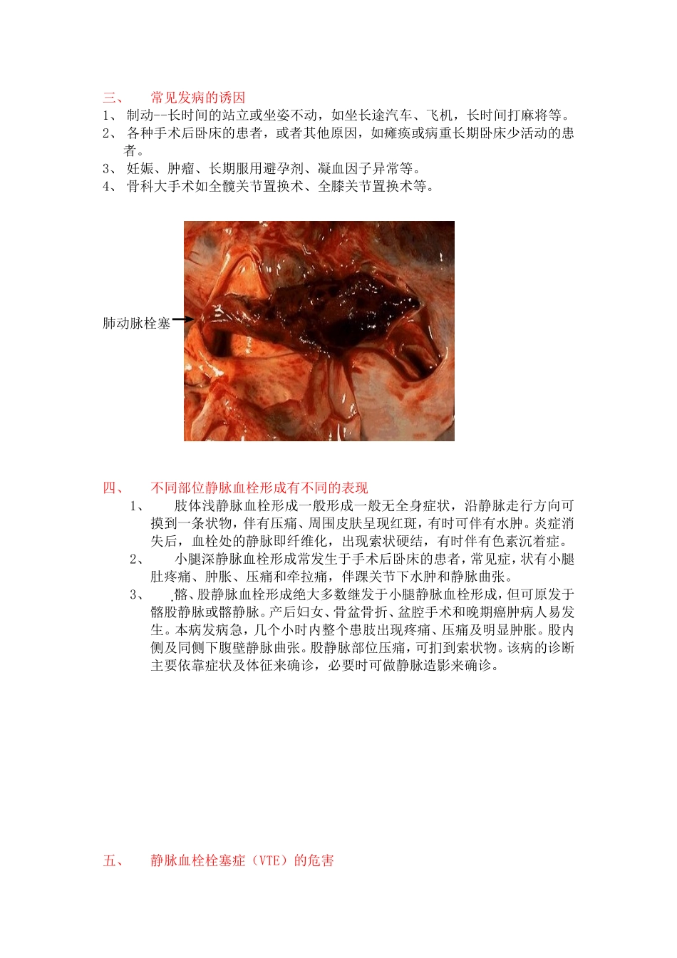 认识静脉血栓栓塞症_第2页