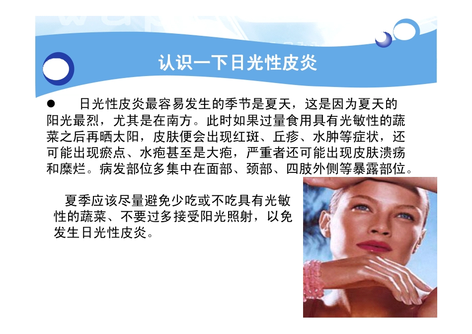 日光性皮炎能治好吗_第2页