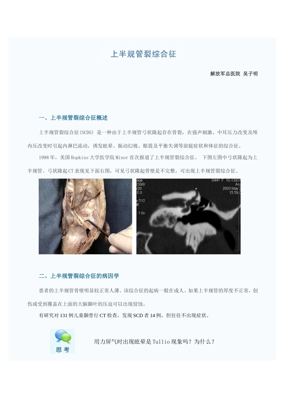 上半规管裂综合征的诊治_第1页
