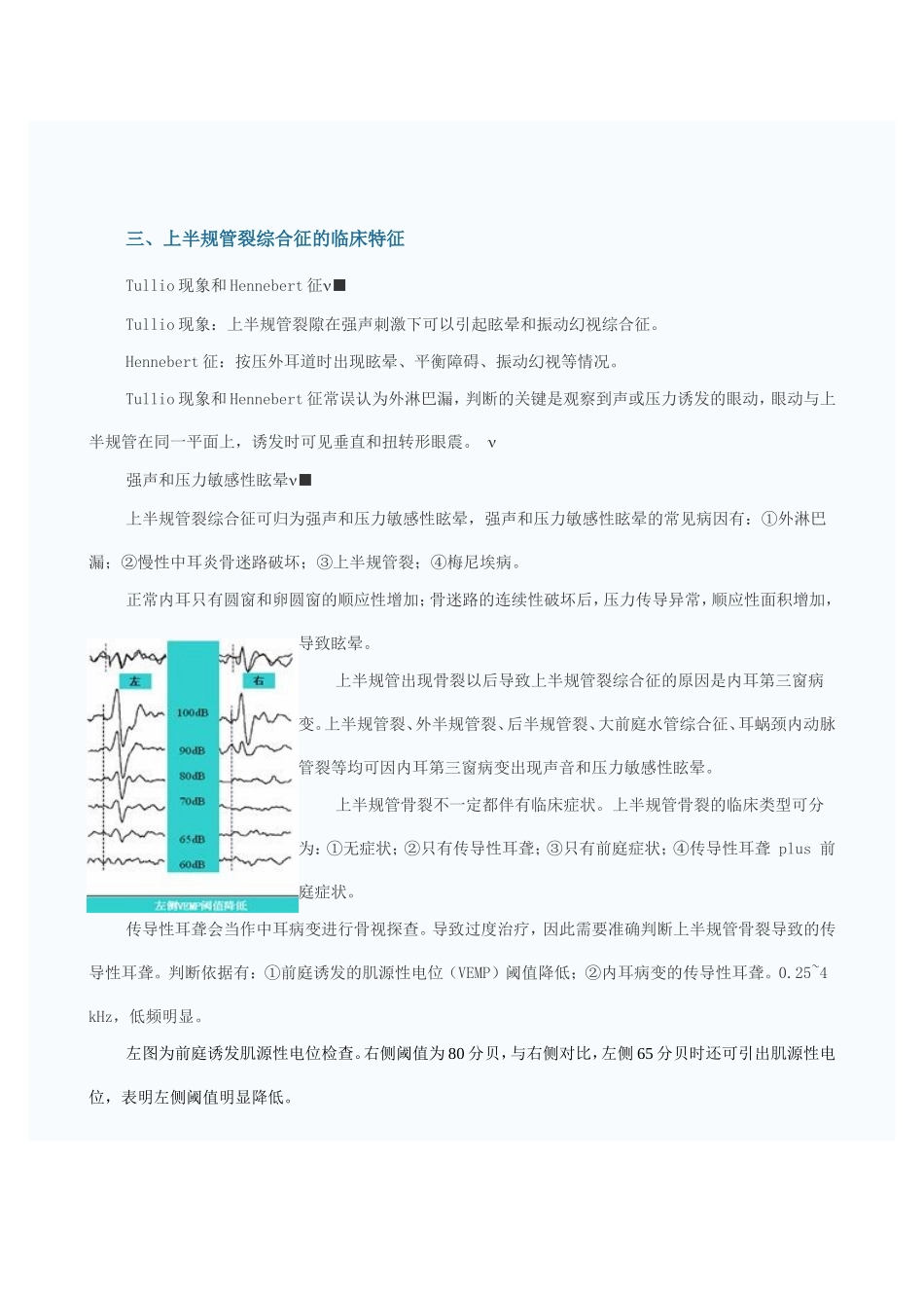 上半规管裂综合征的诊治_第2页