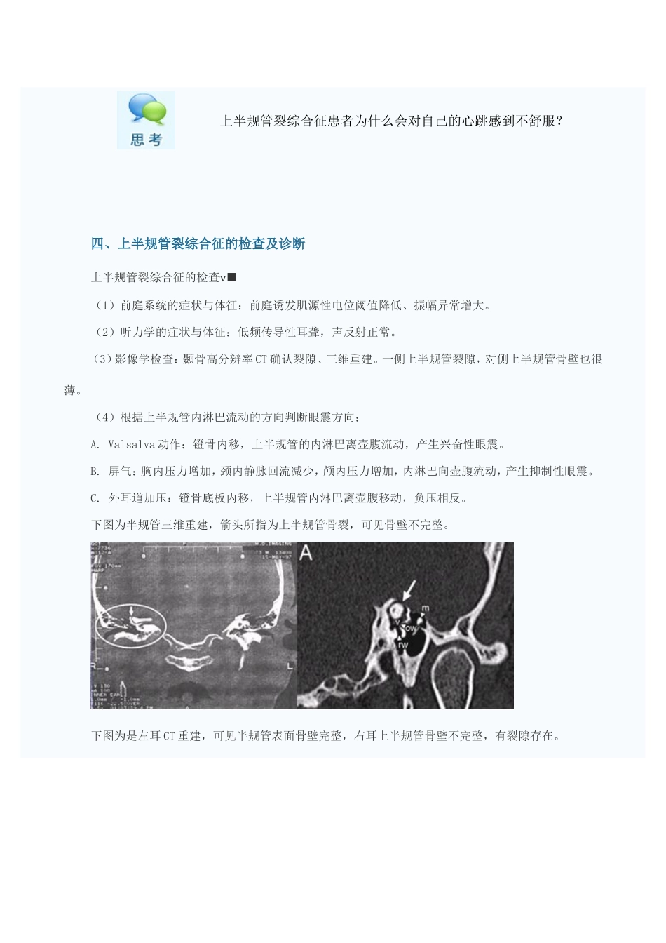 上半规管裂综合征的诊治_第3页