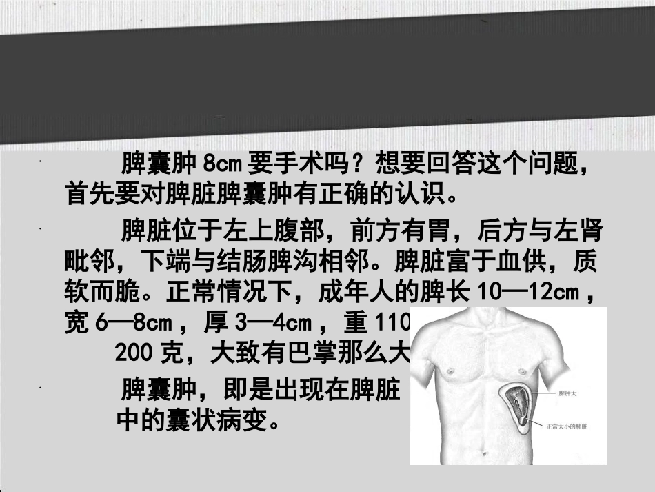 脾囊肿8cm要手术吗_第2页