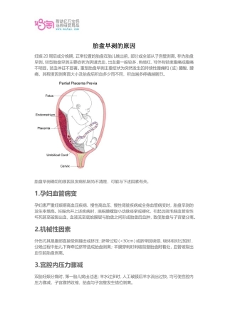 胎盘早剥的原因