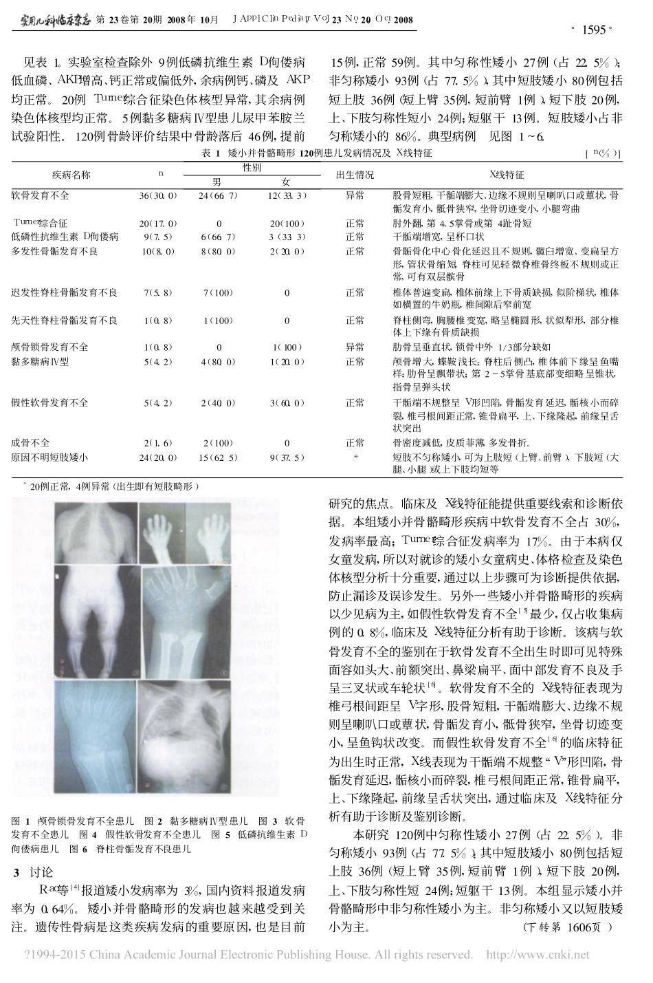 身材矮小并骨骼畸形儿童的临床与X线特征_第2页