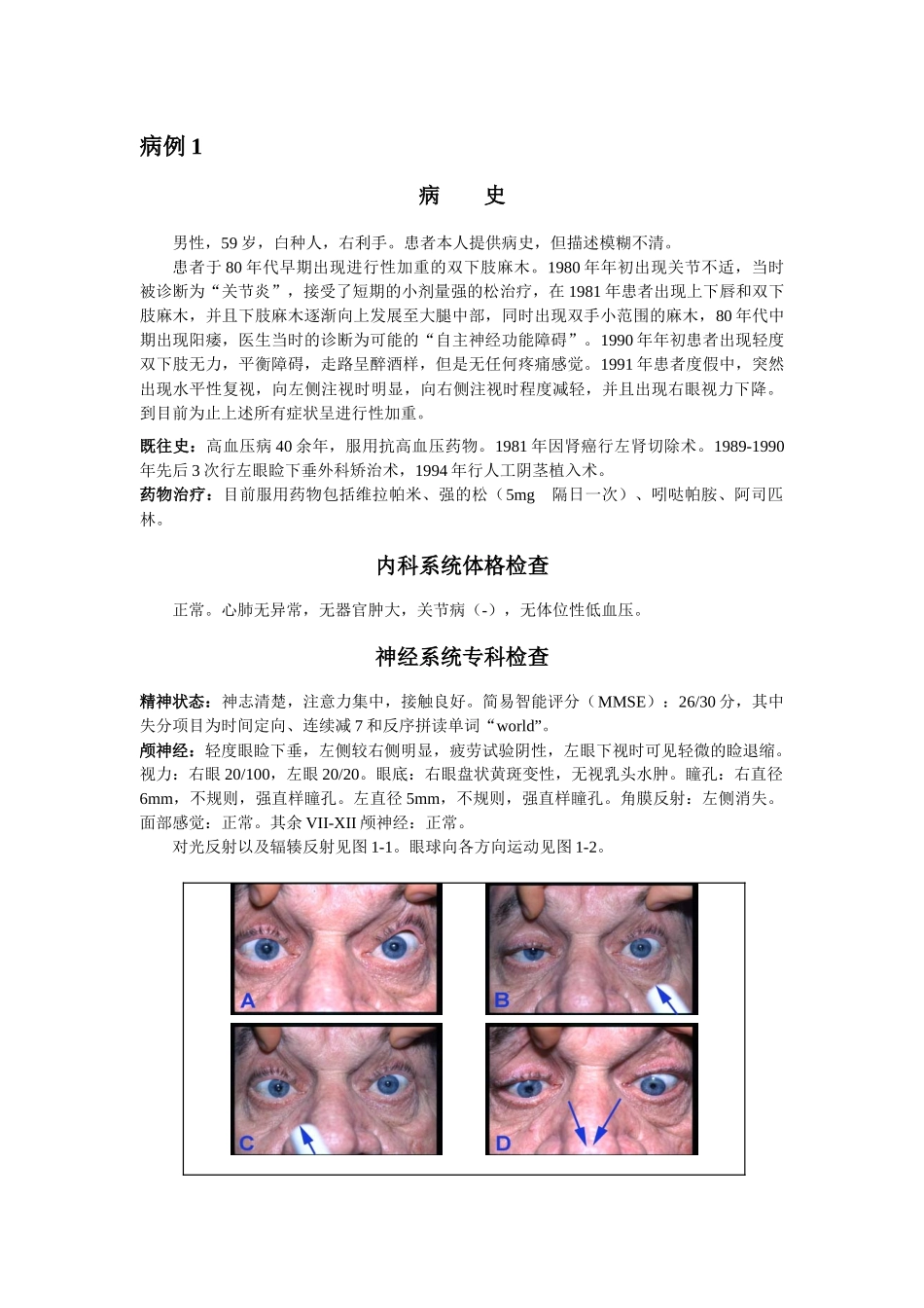 神经科疑难病例——脊髓痨_第1页