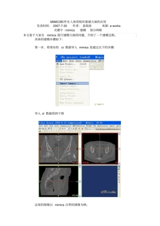 mimics教程总结概要