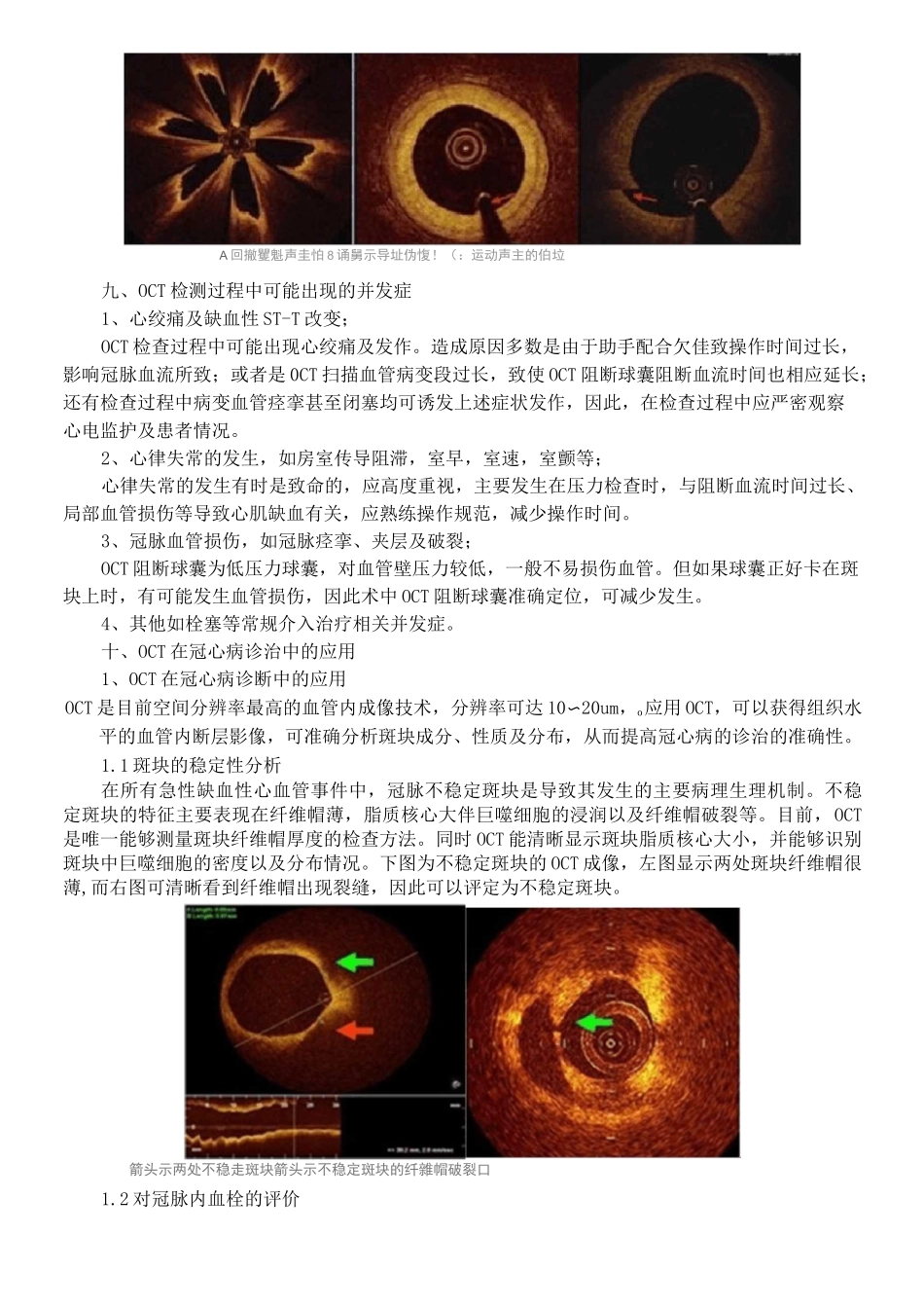 光学相干断层扫描_第3页