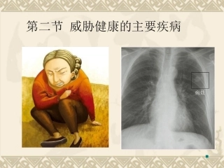 威胁健康的主要疾病