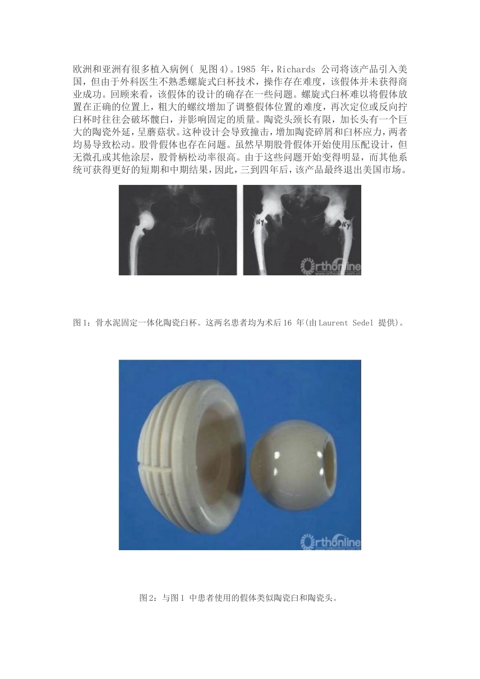 陶瓷髋关节置换术简史_第2页