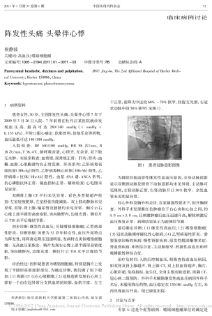 阵发性头痛  头晕伴心悸