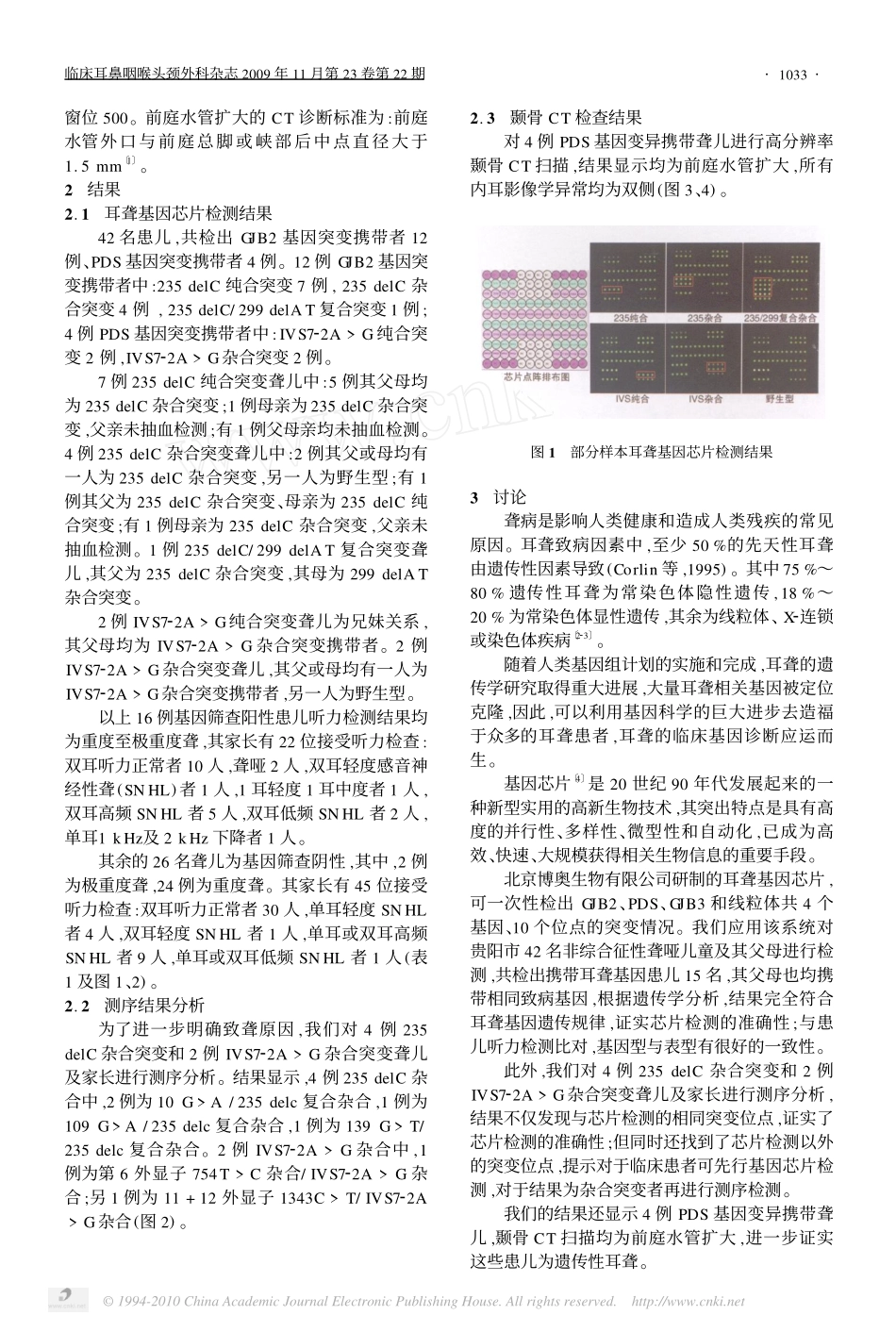 遗传性耳聋基因芯片检测及其临床意义_第2页