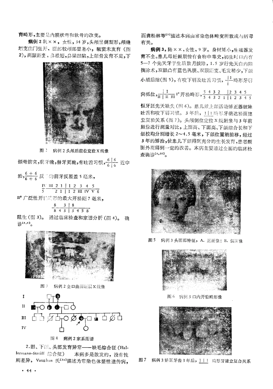 遗传因素与口腔开胎畸形_第2页