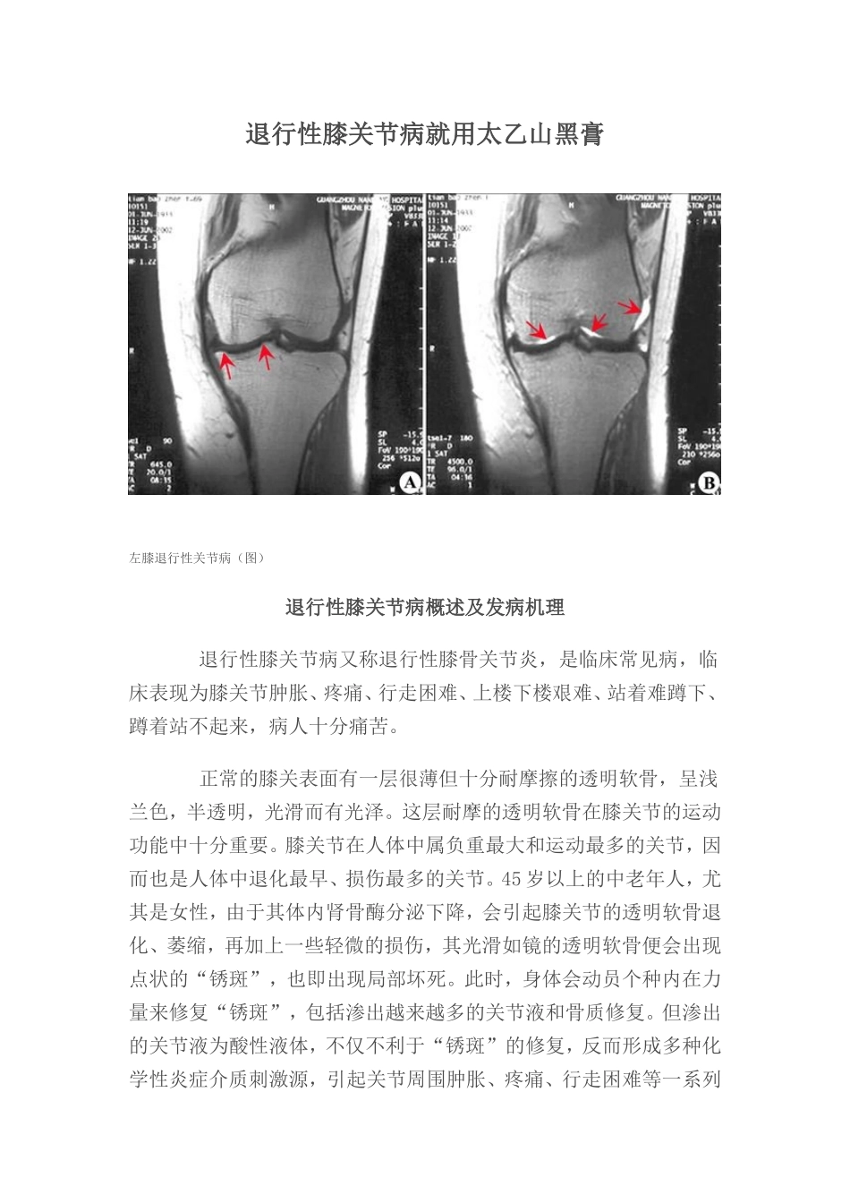 退行性膝关节病就用太乙山黑膏_第1页