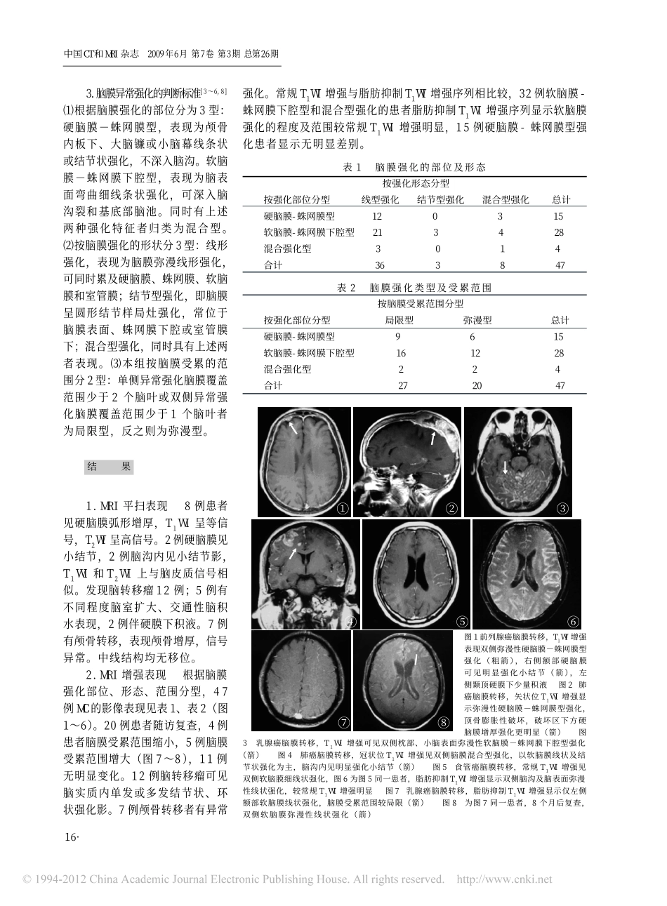 转移性脑膜癌病的MRI表现_第2页