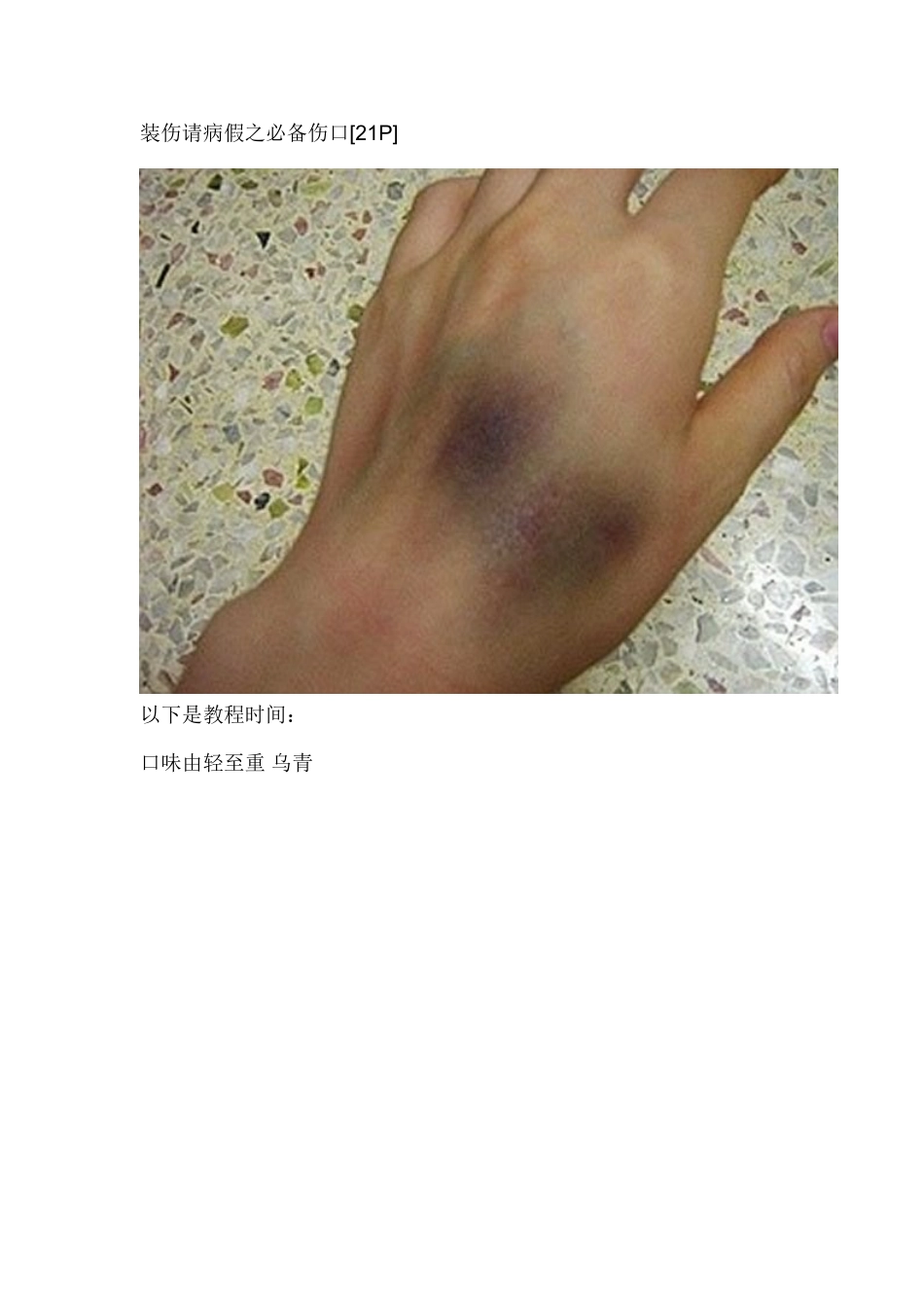 装伤请病假之必备伤口_第1页